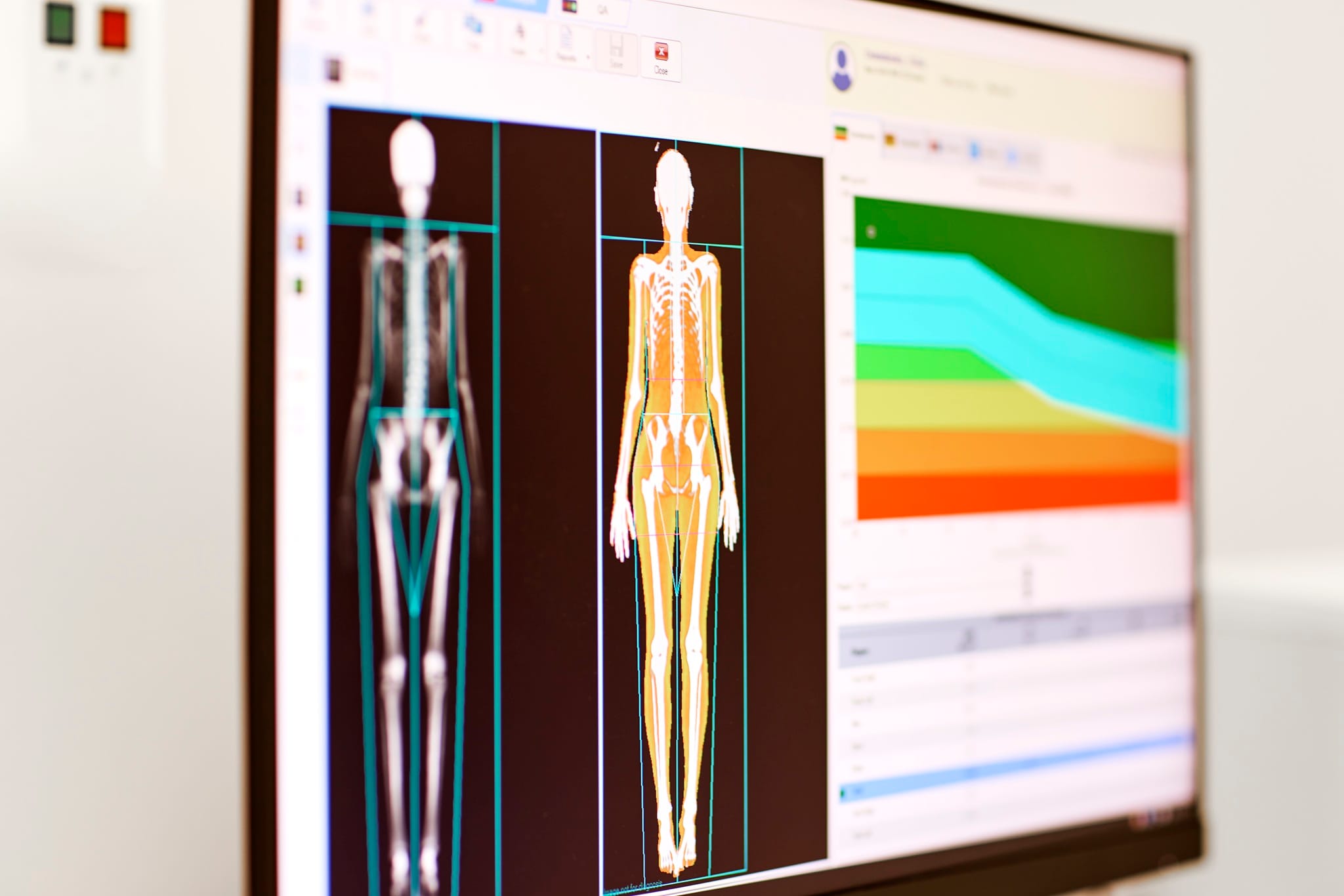 Body Composition